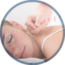 Acupuncture